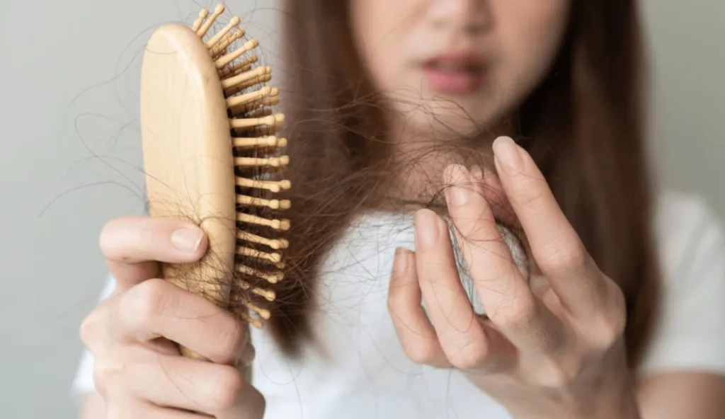 Rụng tóc sau sinh