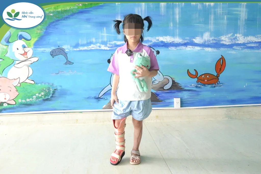 Giữa hành lang Bệnh viện, cô bé 7 tuổi từng phải mang nẹp, bó bột, giờ đã tự tin sải bước