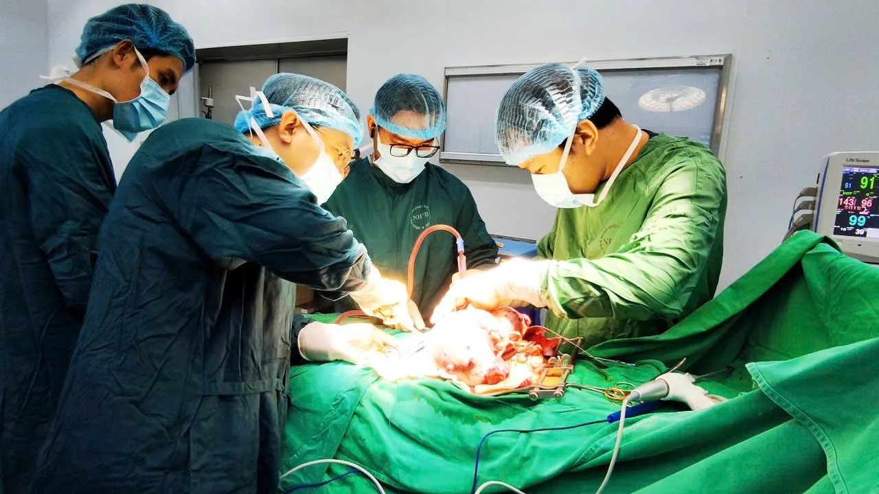 Đội ngũ bác sĩ phẫu thuật lấy khối u