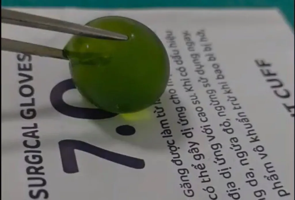 Hạt nở được bác sĩ lấy ra sau khi phẫu thuật