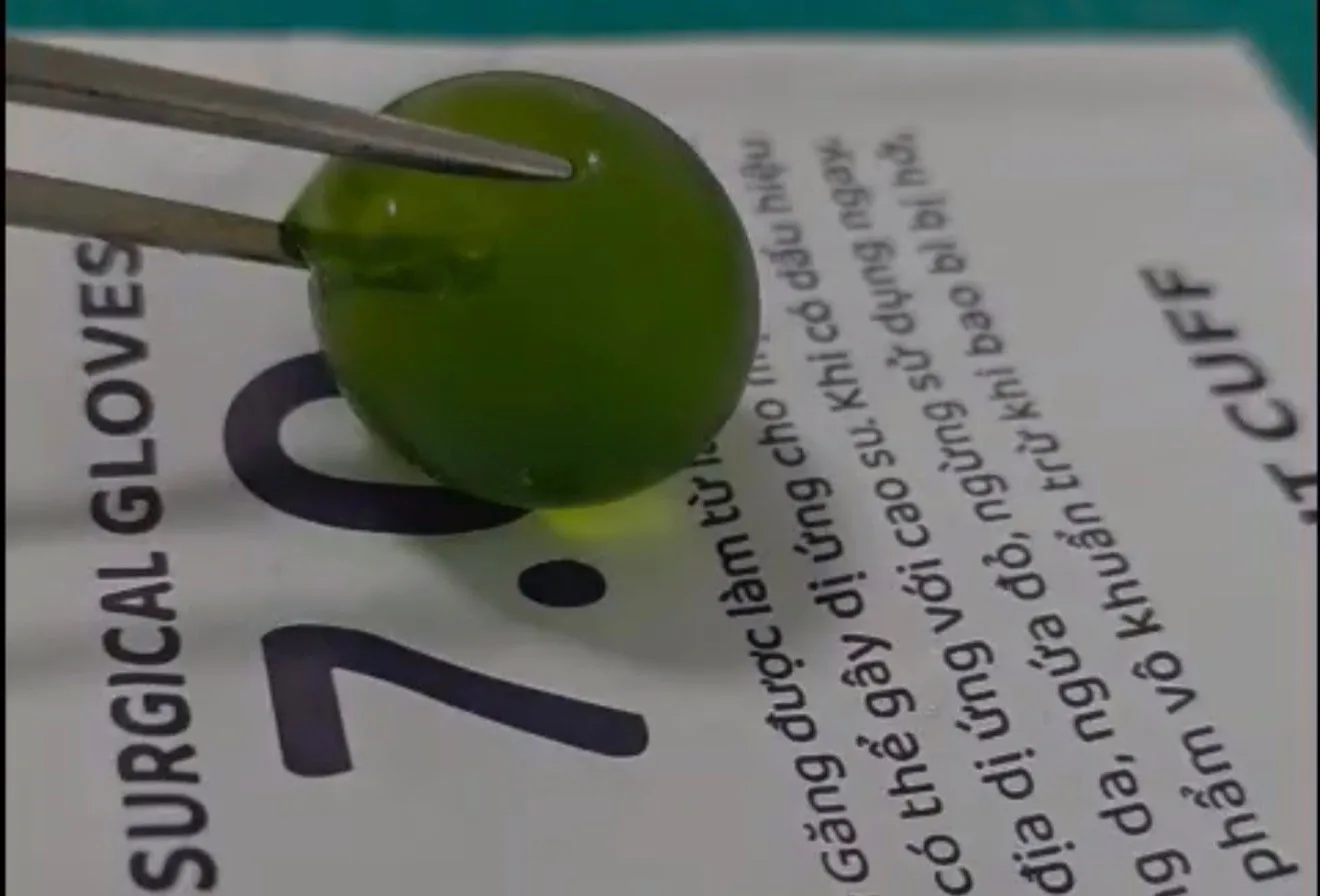 Hạt nở được bác sĩ lấy ra sau khi phẫu thuật