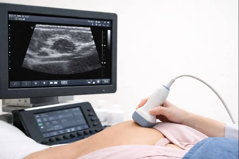Siêu âm tuyến vú và hạch nách tầm soát ung thư vú