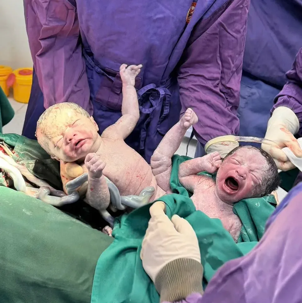 2 bé chào đời an toàn sau ca phẫu thuật