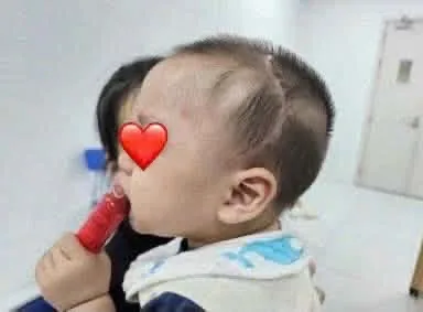 Hình ảnh bé sau phẫu thuật